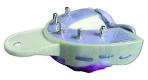 Miratray Implant
