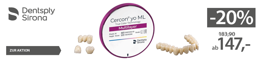 Cercon yo ML - bis zu -20% sparen!