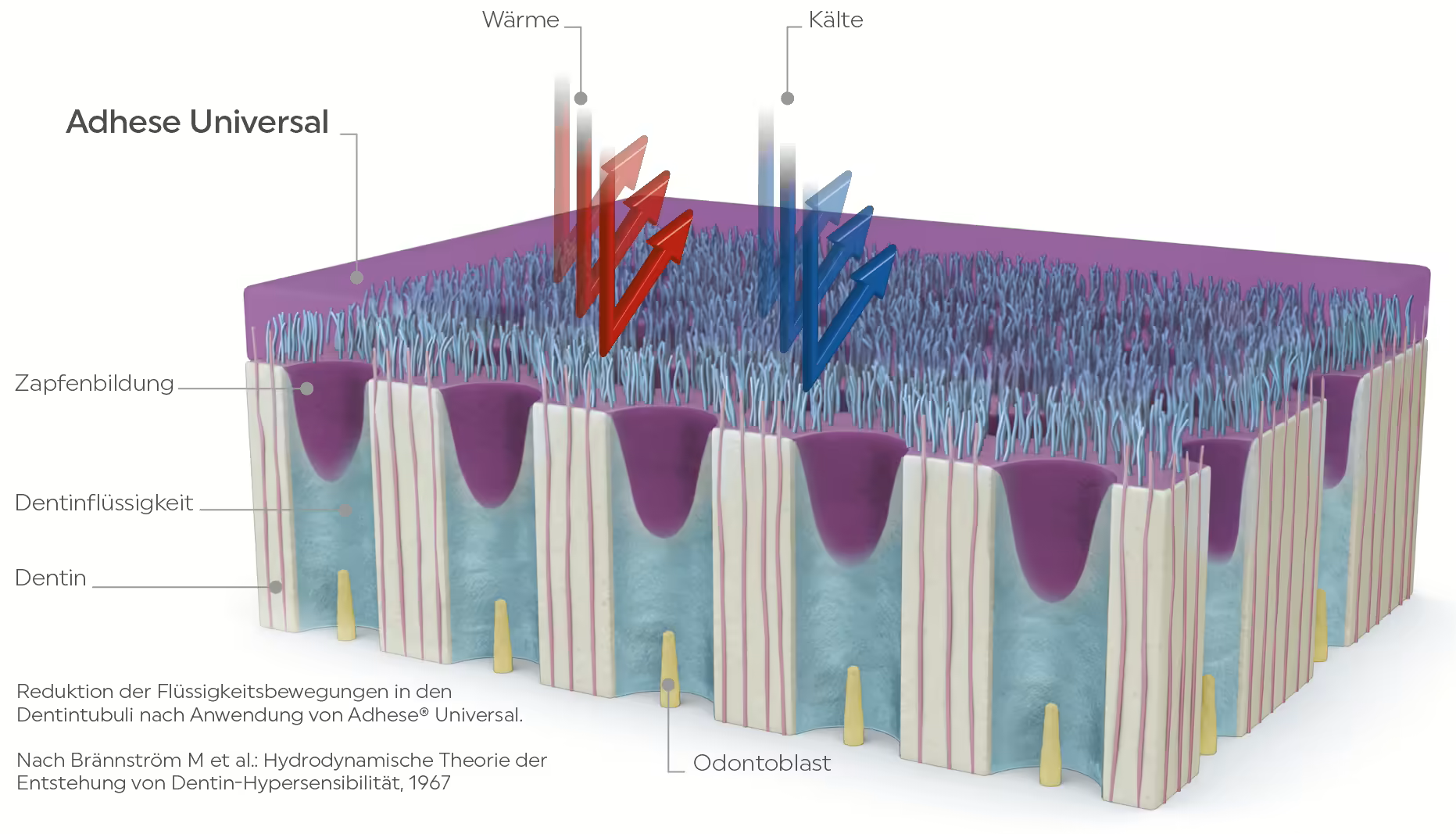 Adhese_Universal_Desensitizing_DE