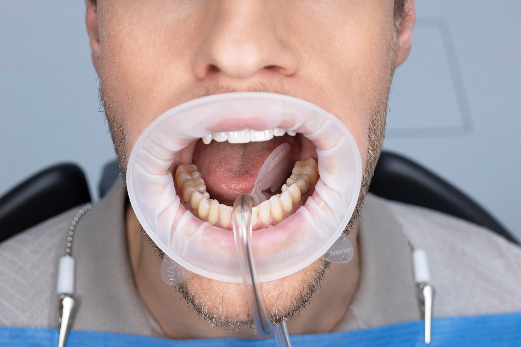 251126_OptraGate_Dry_Control_1168_2000x1333px