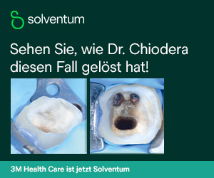 Selbstadhäsive Stift-Befestigung, Adhäsiver Stumpfaufbau, Selbstadhäsive Kronenbefestigung: Fallbericht von Dr. Giuseppe Chiodera