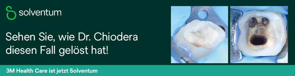 self-adhesive-and-crown-cementation-clinical-case-banner-970x250-ds-de-v1fv_8383329