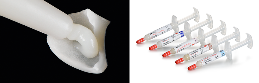 Abbildung 3: 3M™ RelyX™ Veneer Try-In-Pasten in verschiedenen Farbtönen, die zu 3M™ RelyX™ Veneer und 3M™ RelyX™ Universal Befestigungskomposit passen.