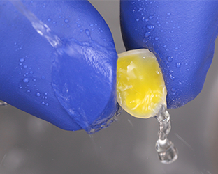 Bild, das die Behandlung mit Veneers zeigt.