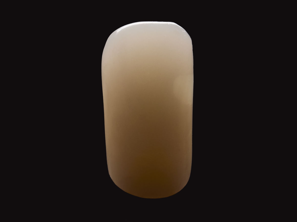 Abbildung 3 Präparation Nachher mit Material eines anderen Herstellers ohne Blocker - Spuren zu erkennen