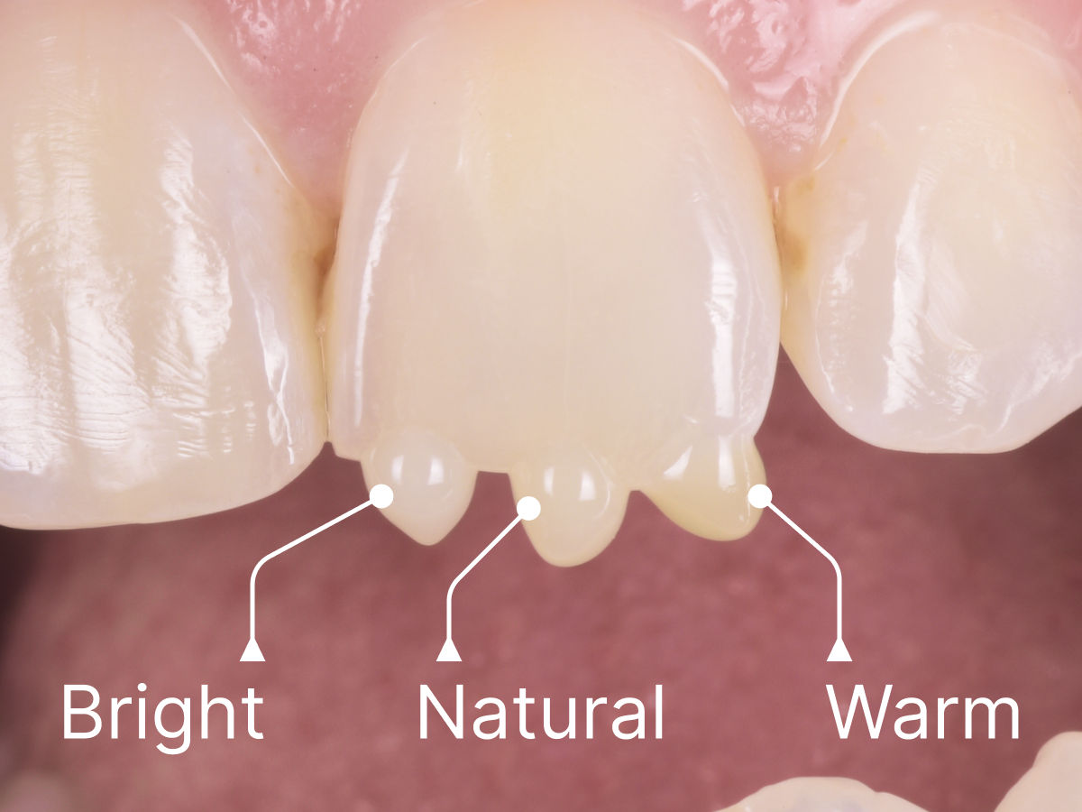 Abbildung Farbauswahl Bright, Natural und Warm auf Zahnschmelz