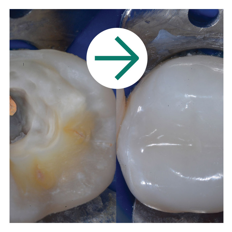 filtek-bulk-fill-flowable-restorative-pdp-module-3-ds-rps