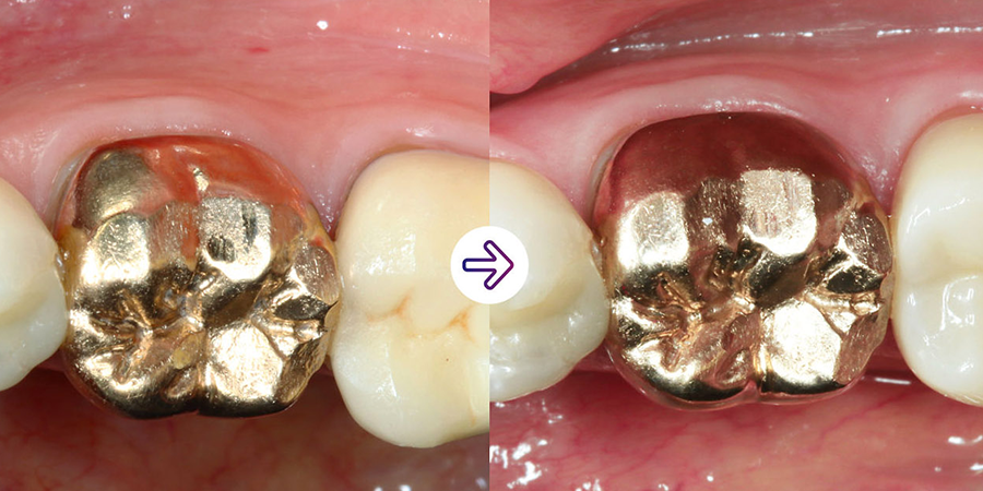 Solv_Page_Impregum_Penta_Super_Quick_IIIn_290px