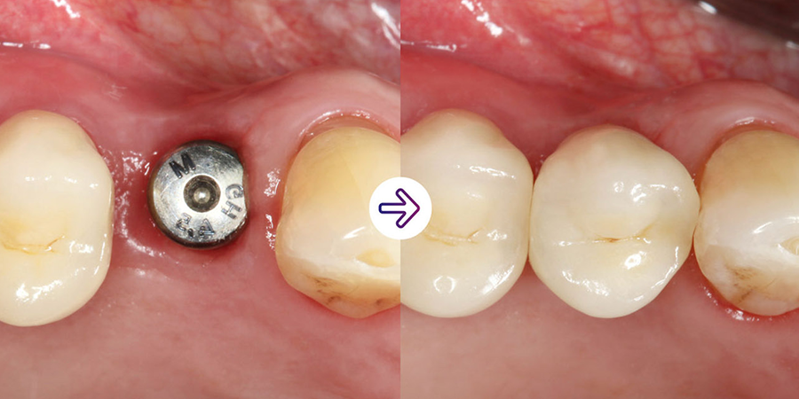 Solv_Page_Impregum_Penta_Super_Quick_I_290px