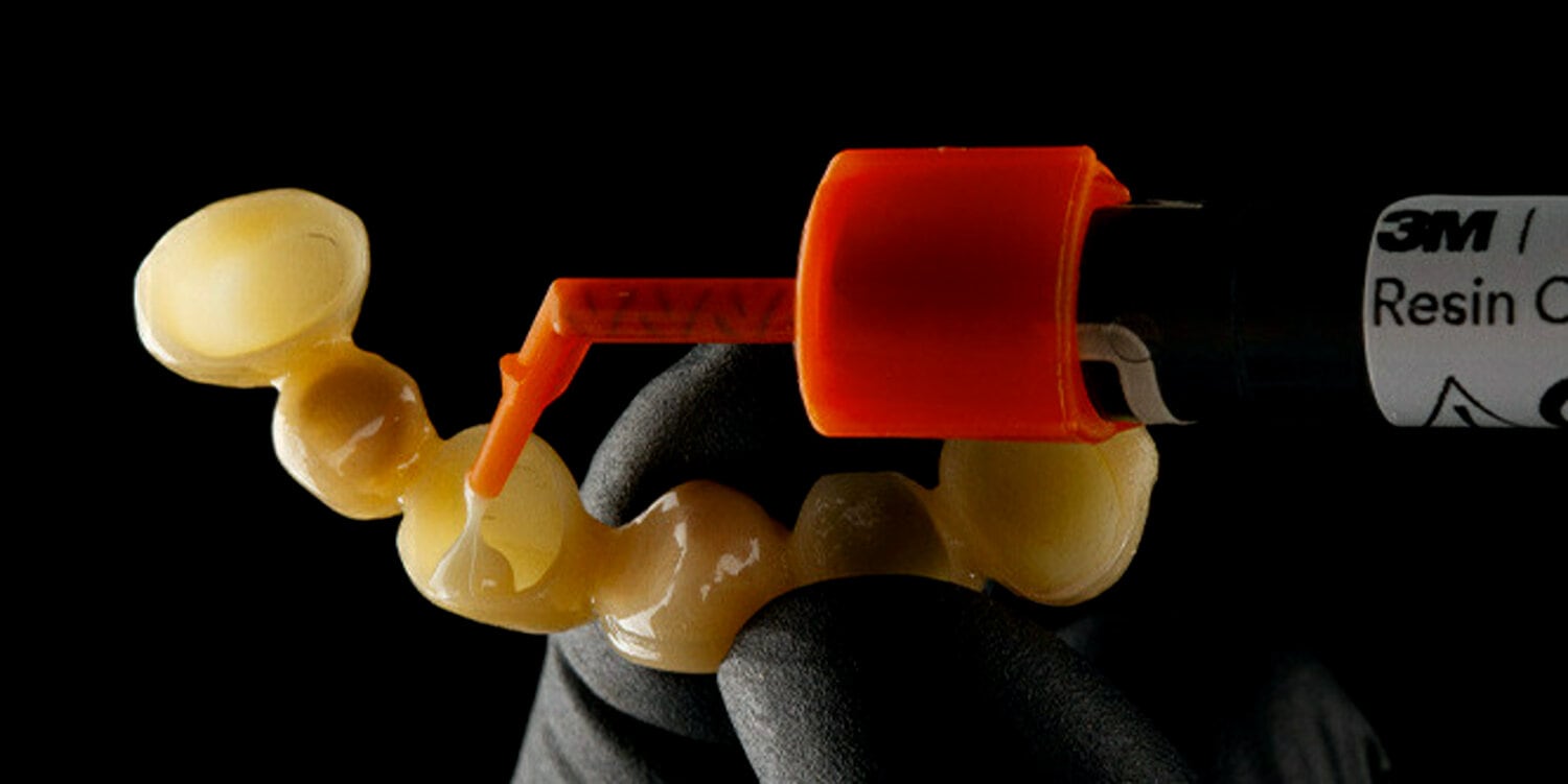 pdp-case-study-image-of-cement-being-applied-to-dental-bridge